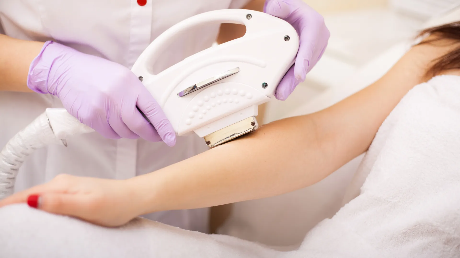 Θεραπεία υπερμελάγχρωσης με IPL Laser