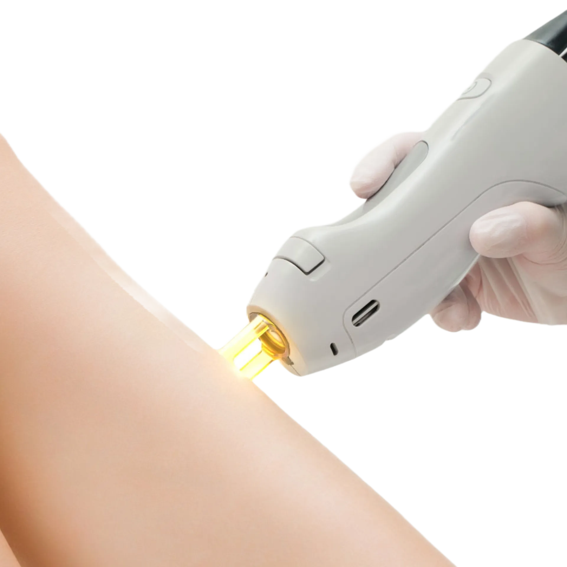 Θεραπείες Laser